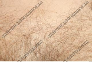 human skin hairy 0007